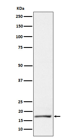 Anti-GCDFP 15 Rabbit Monoclonal Antibody