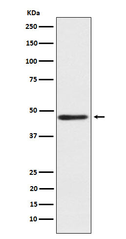 Anti-ENTPD5 Rabbit Monoclonal Antibody