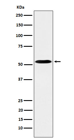 Anti-PKA RII alpha Rabbit Monoclonal Antibody
