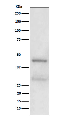 Anti-MBD2 Rabbit Monoclonal Antibody