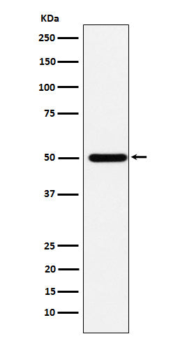 Anti-ABAT Rabbit Monoclonal Antibody