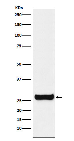 Anti-GSTM1 Rabbit Monoclonal Antibody