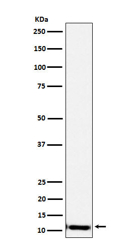 Anti-SPINK1 Rabbit Monoclonal Antibody