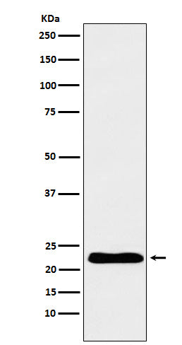 Anti-Troponin I Rabbit Monoclonal Antibody
