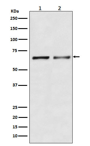 Anti-Activin Receptor Type IIB Rabbit Monoclonal Antibody