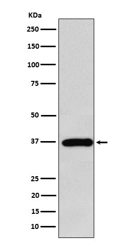 Anti-FBP1 Rabbit Monoclonal Antibody