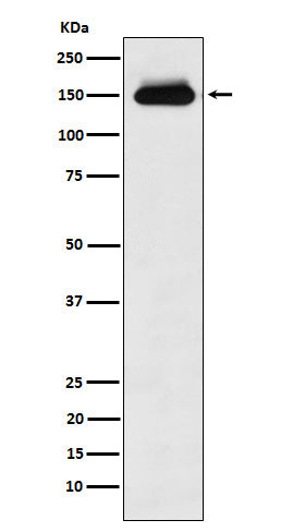 Anti-TIMELESS Rabbit Monoclonal Antibody
