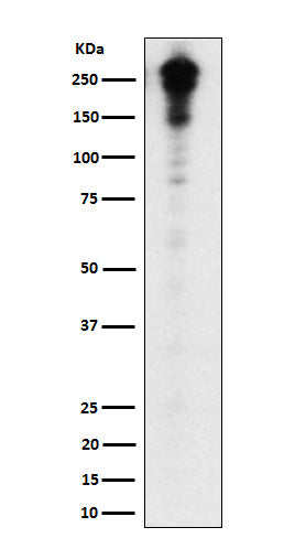 Anti-Desmoplakin Rabbit Monoclonal Antibody