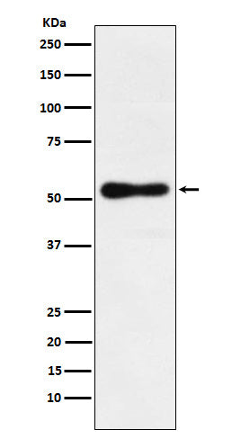 Anti-RORB Rabbit Monoclonal Antibody