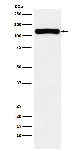 Anti-VPS11 Rabbit Monoclonal Antibody