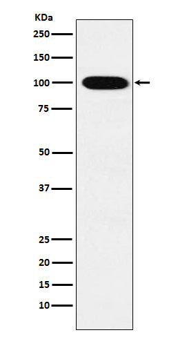 Anti-VPS18 Rabbit Monoclonal Antibody