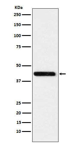 Anti-Cystathionase Rabbit Monoclonal Antibody