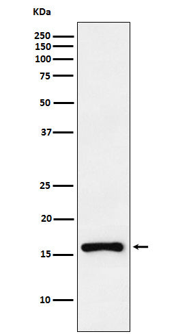 Anti-CDKN2C Rabbit Monoclonal Antibody