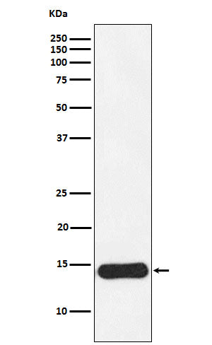 Anti-CRABP1 Rabbit Monoclonal Antibody