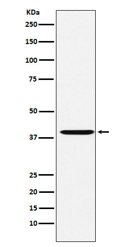 Anti-Actin Regulatory Protein CAPG Rabbit Monoclonal Antibody