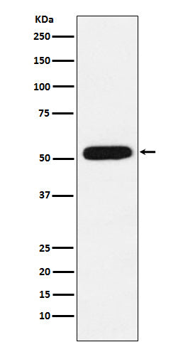 Anti-CBX4 Rabbit Monoclonal Antibody