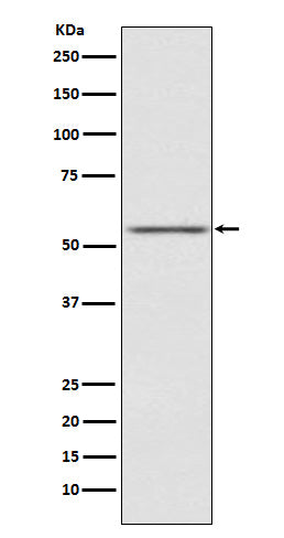 Anti-AMHR2 Rabbit Monoclonal Antibody