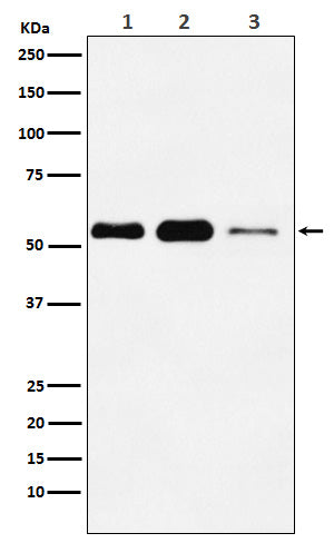 Anti-Adipose Triglyceride Lipase Rabbit Monoclonal Antibody