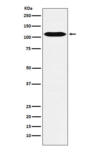 Anti-LGR6 Rabbit Monoclonal Antibody