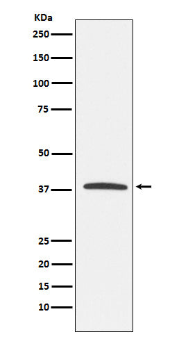 Anti-KLRG1 Rabbit Monoclonal Antibody