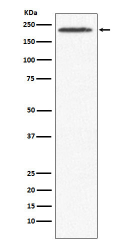 Anti-SMCHD1 Rabbit Monoclonal Antibody