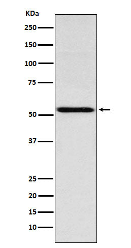 Anti-Thyroid Hormone Receptor alpha Rabbit Monoclonal Antibody