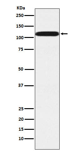 Anti-PUM2 Rabbit Monoclonal Antibody