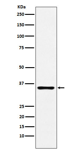Anti-DcR2 Rabbit Monoclonal Antibody
