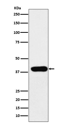 Anti-Adenosine Deaminase Rabbit Monoclonal Antibody