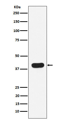 Anti-HLA B Rabbit Monoclonal Antibody