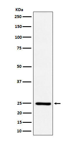 Anti-Ephrin A1 Rabbit Monoclonal Antibody