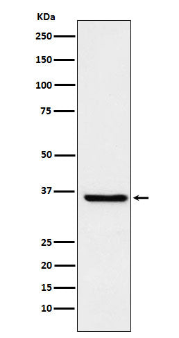 Anti-FGF19 Rabbit Monoclonal Antibody