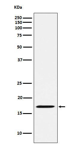 Anti-FHIT Rabbit Monoclonal Antibody