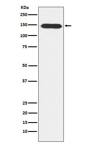Anti-Phospholipase C beta 3 Rabbit Monoclonal Antibody