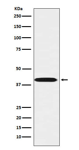 Anti-LHX3 Rabbit Monoclonal Antibody