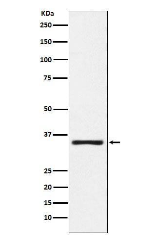 Anti-Kallikrein 2 Rabbit Monoclonal Antibody