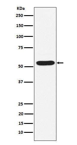 Anti-PIAS2 Rabbit Monoclonal Antibody