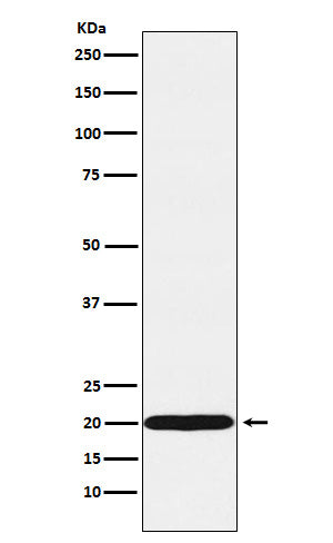 Anti-Ubiquitin Conjugating Enzyme E2 C Rabbit Monoclonal Antibody