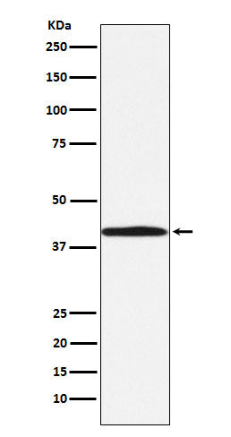 Anti-BGAT Rabbit Monoclonal Antibody