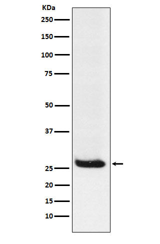 Anti-Hippocalcin  Rabbit Monoclonal Antibody