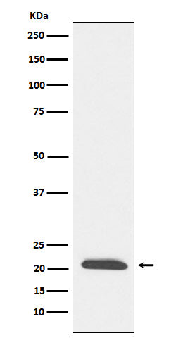 Anti-Dynactin Subunit 3 Rabbit Monoclonal Antibody
