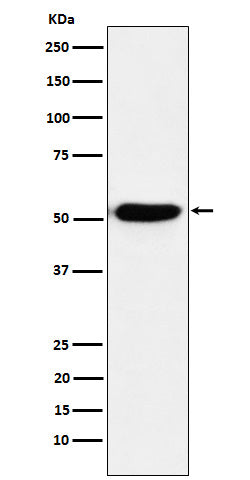 Anti-Interferon Regulatory Factor 4 Rabbit Monoclonal Antibody