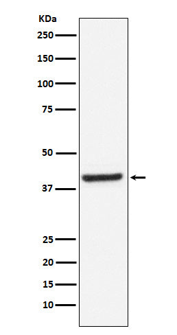 Anti-Inhibin beta A Rabbit Monoclonal Antibody