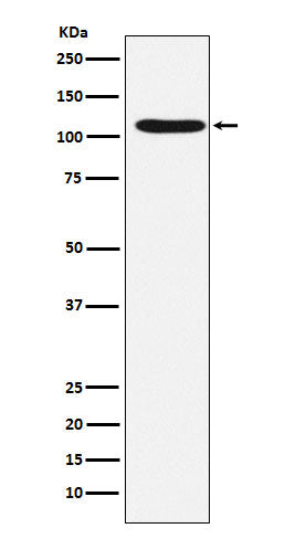 Anti-HIRA Rabbit Monoclonal Antibody