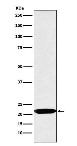 Anti-Oncostatin M Rabbit Monoclonal Antibody