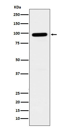 Anti-GLB1 Rabbit Monoclonal Antibody