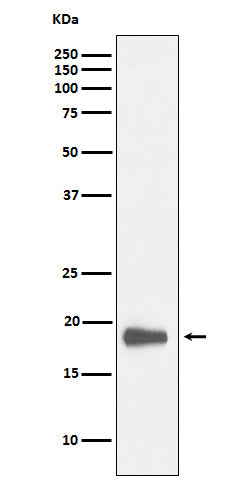 Anti-HMGN2 Rabbit Monoclonal Antibody