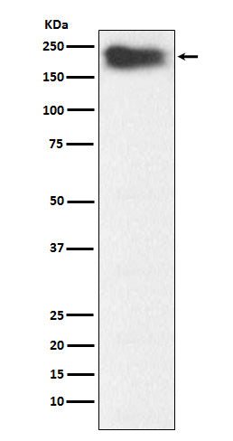 Anti-MYH7B Rabbit Monoclonal Antibody