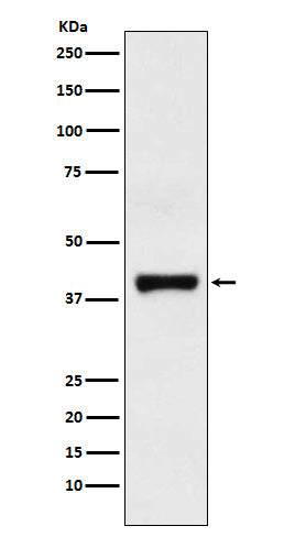 Anti-GOT2 Rabbit Monoclonal Antibody