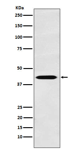 Anti-TNFRSF19 Rabbit Monoclonal Antibody